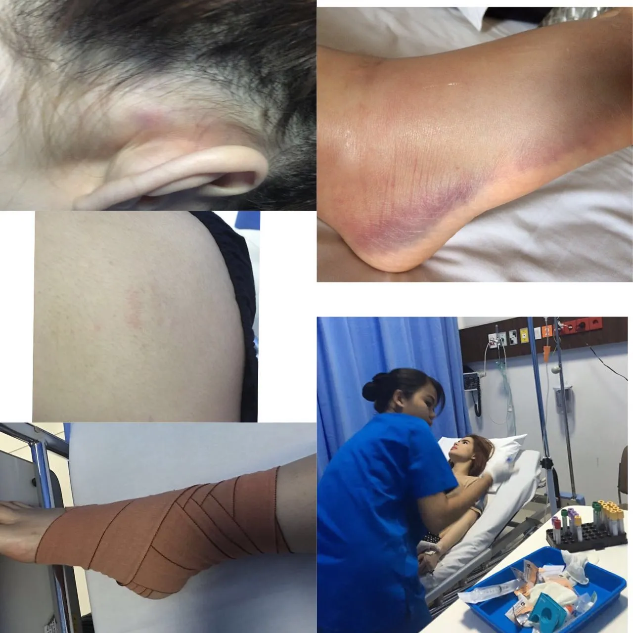 Akibat Penganiayaan © Twitter