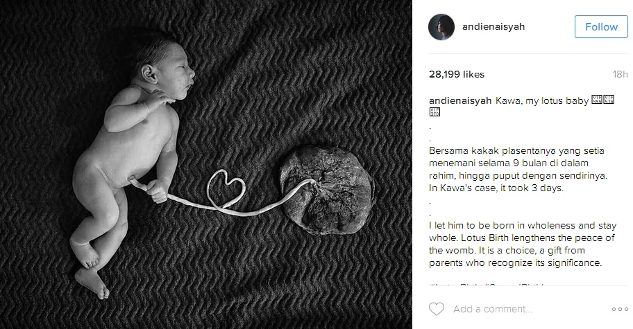 Andien memakai metode lotus birth untuk Kawa ©instagram/andienaisyah