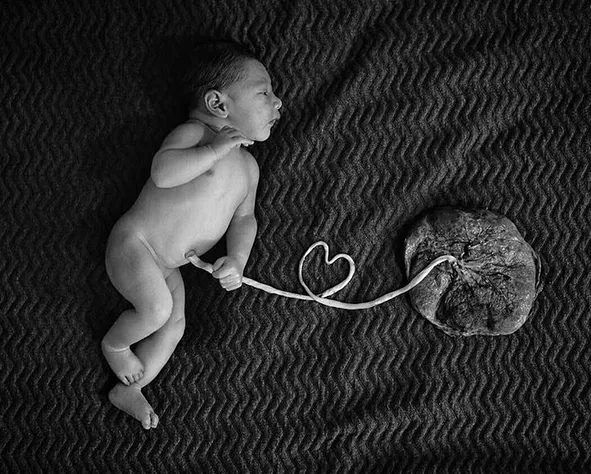 Lotus birth, Andien tak memotong ari-ari Kawa ketika lahir ©instagram/andienaisyah