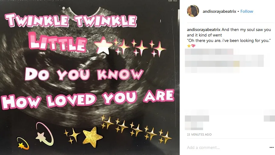 USG anak Andi Soraya, sudah enam bulan ©instagram/andisorayabeatrix