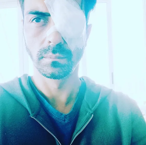 Begini kondisi mata Arjun sekarang ©instagram/arjun72