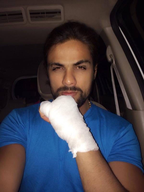Ini dia momen Arpit Ranka tunjukkan luka di tangannya usai alami kecelakaan @twitter.com/arpitduryodhan