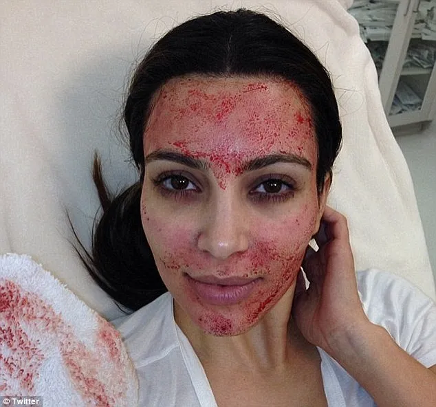 Maunya niru Kim Kardashian. @twitter