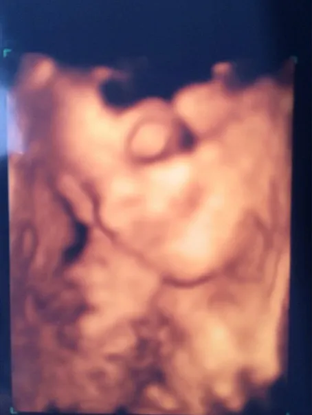 Penampakan bayi Ashanty di dalam perut @ Instagram/Ashanty