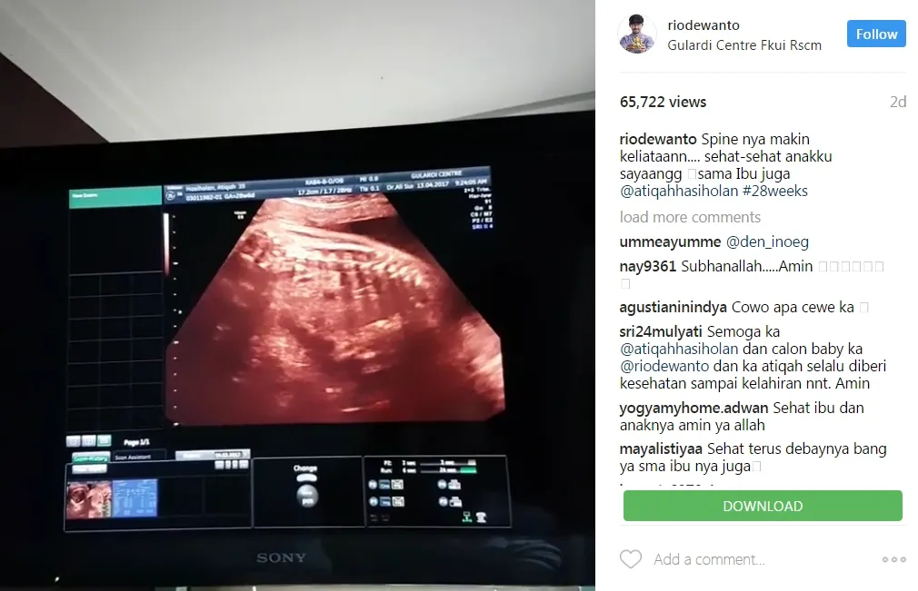 Rio Dewanto berbagi hasil USG anaknya. © instagram.com/riodewanto