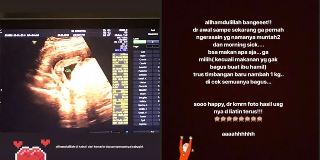 Credit: Instagram/aurakasih