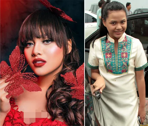 Aurel juga sering dihujat dan dikabarkan oplas © istimewa