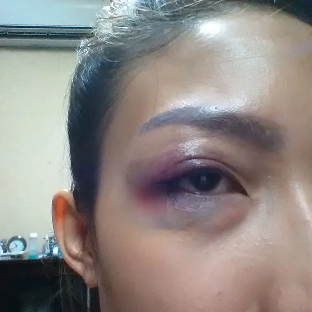 Ayu Dewi Mengalami kecelakaan saat tampil © Instagram/Ayu Dewi