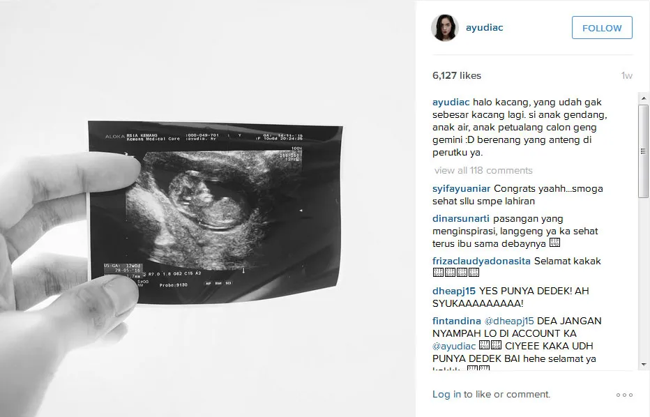 Ayudia ungah foto USG © Instagram/ayudiac