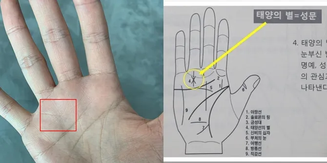 Telapak Tangan Baekhyun © Istimewa