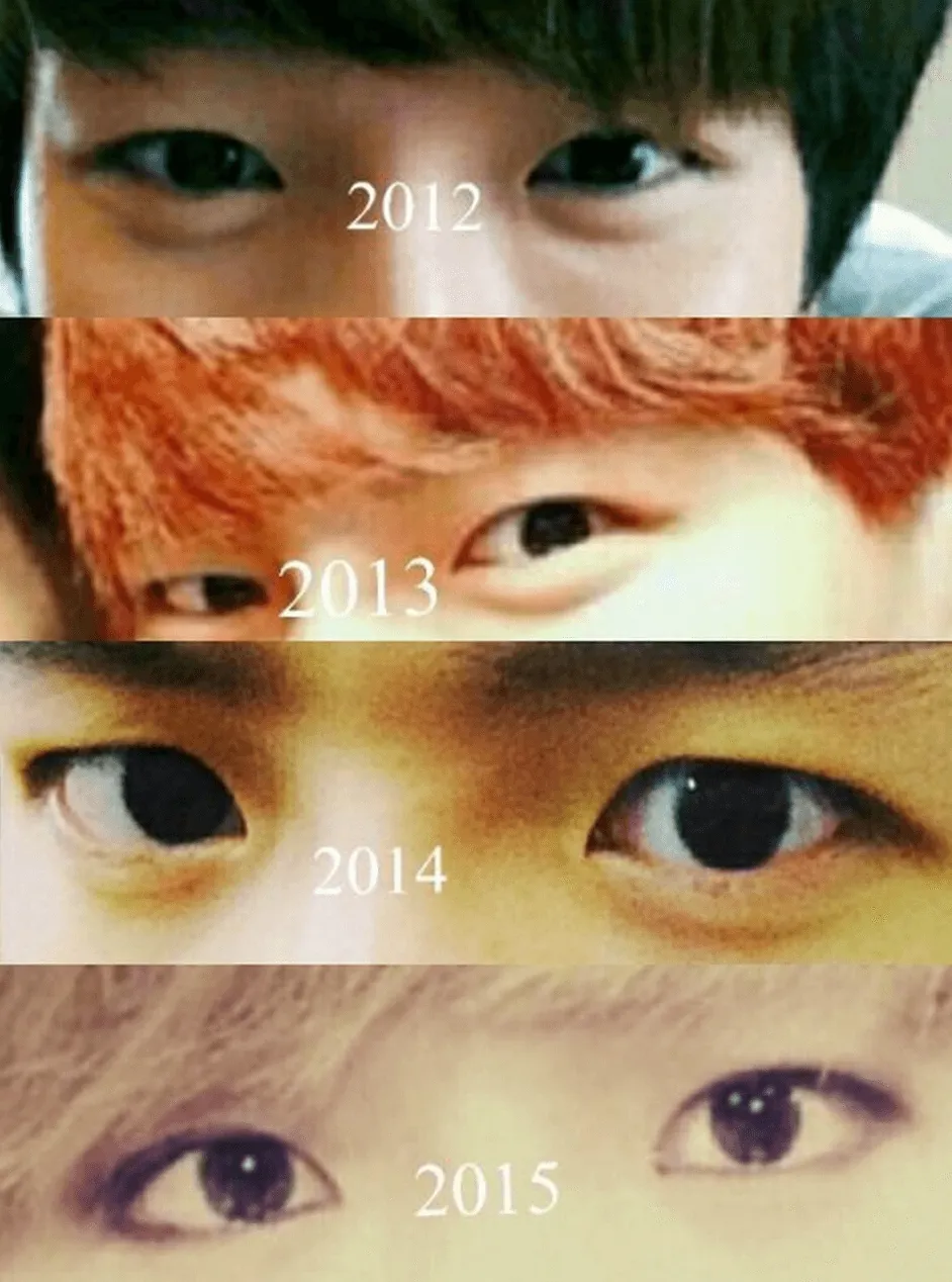 Foto bukti yang diunggah penggemar Baekhyun demi membuktikan kalau sang idol tak melakukan oplas. © koreaboo.com