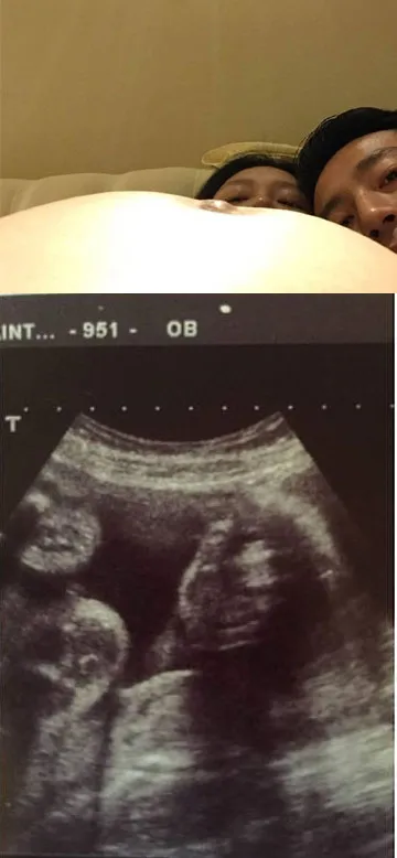 Barbie Hsu yang memamerkan foto perut telanjangnya, diduga hamil anak kembar. ©toggle.sg