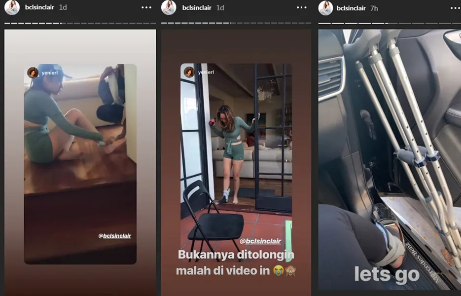 Bunga Citra Lestari Cedera Engkel credti: instagram.com/bclsinclair