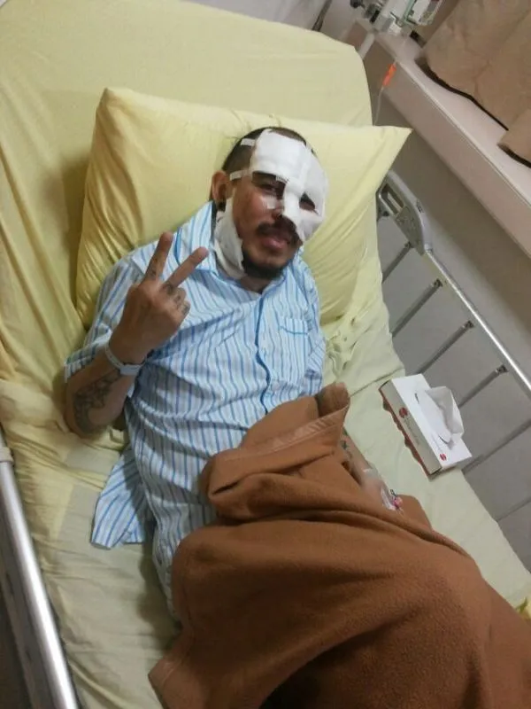 Beery ketika dirawat.