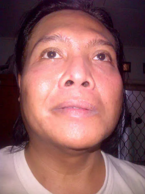 Ageng Kiwi terserang penyakit bells' palsy © KapanLagi.com