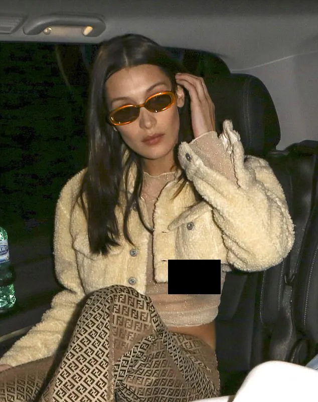 Bella alami nip slip saat masuk ke dalam mobil © dailymail.co.uk