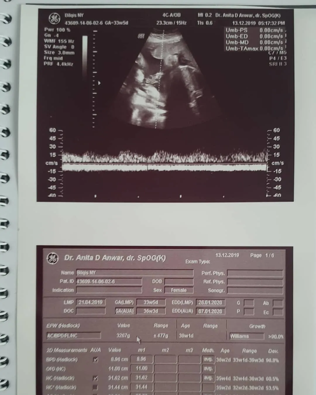 Instagram/bylqisjuwitaningsih