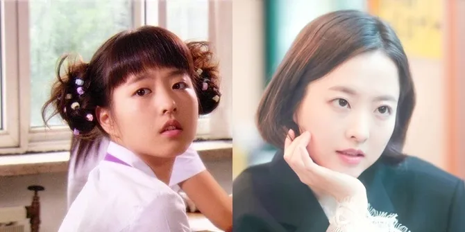 Park Bo Young © Istimewa