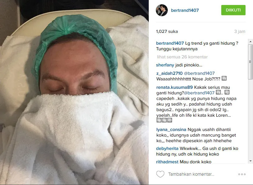 Bertrand Antolin operasi di hidung? © Instagram.com/bertrand1407