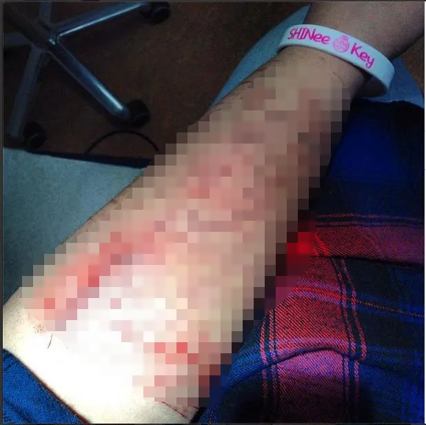 Instagram ugly_fatty_cutter