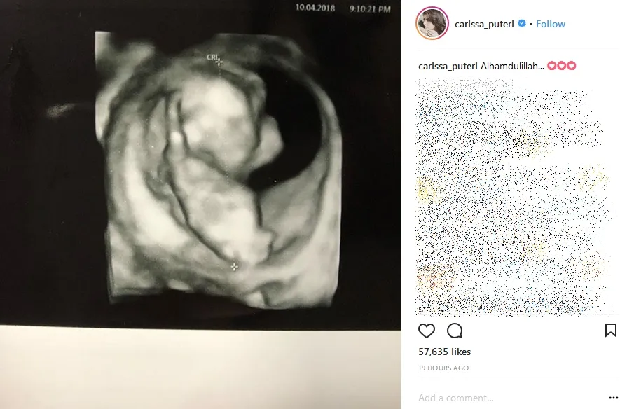 Carissa umumkan kehamilan kedua ©instagram/carissa_puteri
