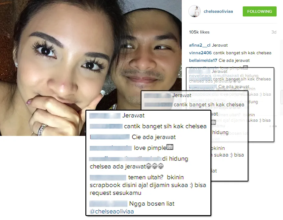 Pamer jerawat, Chelsea ungkap kebahagiaan bersama Glenn © Instagram/chelseaoliviaa