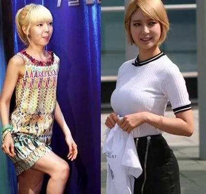 Choa AOA yang dituding menggunakan pad. © netizenbuzz.com