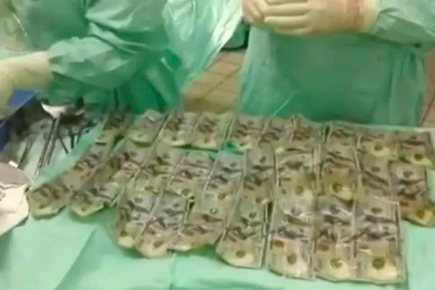Seorang wanita Kolombia dilarikan ke rumah sakit karena menelan sejumlah uang bulat-bulat © mirror.co.uk