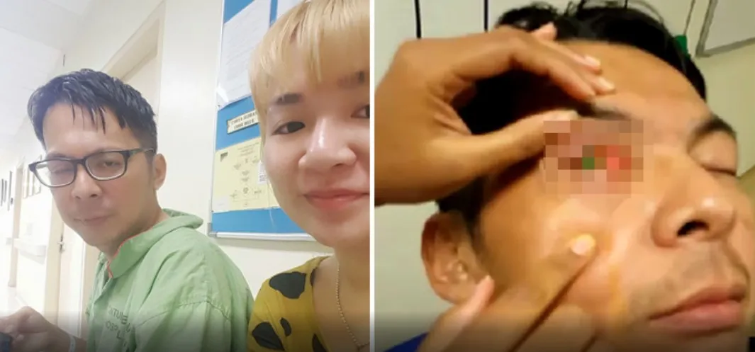 Pria Ini Buta Karena Contact Lens © World of Buzz