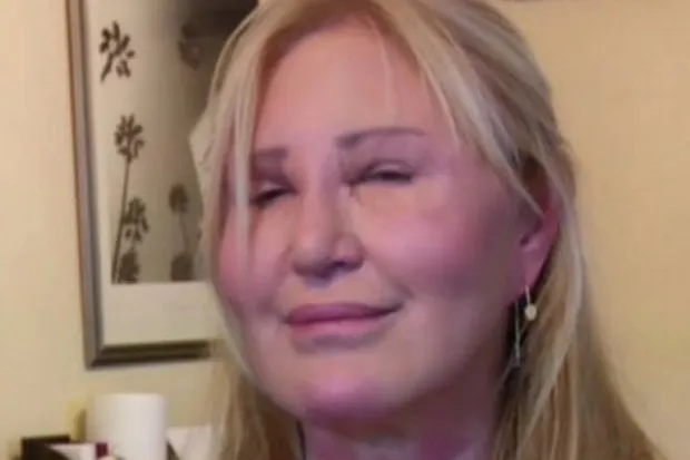 Wanita ini sempat mengurung diri selama 3 tahun karena tidak PD dengan penampilannya © dailystar.co.uk