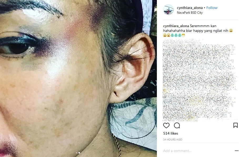 Alona tak mau lapor ke polisi meski ia sudah dianiaya berulang kali ©instagram/cynthiara_alona