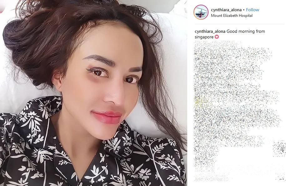 Ada apa dengan bibir Cynthiara Alona? ©instagram.com/cynthiara_alona