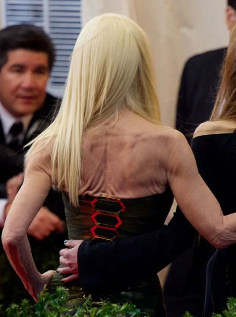 Penampakan punggung Donatella yang luntur dimakan usia @ dailymail.co.uk