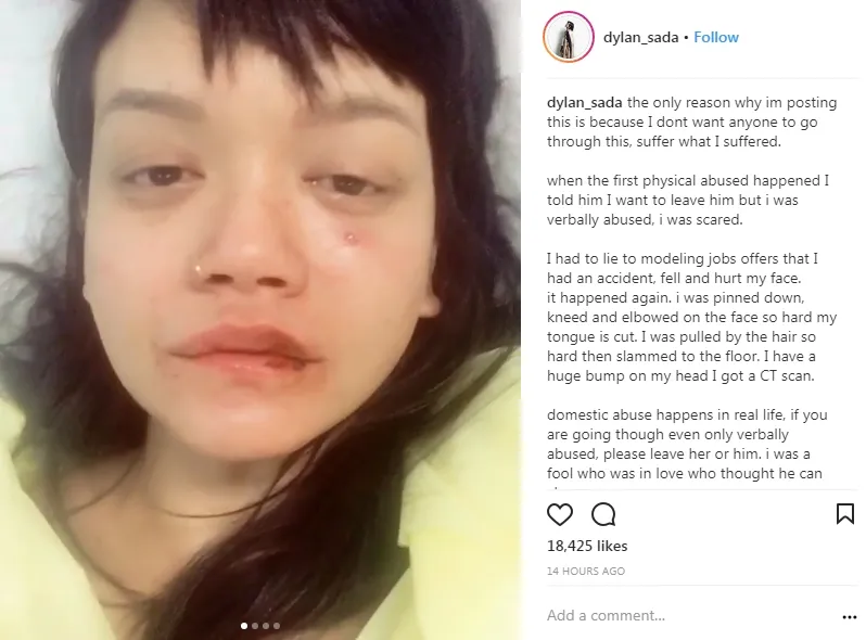 Dylan Sada mengalami kekerasan dalam hubungannya ©instagram/dylan_sada
