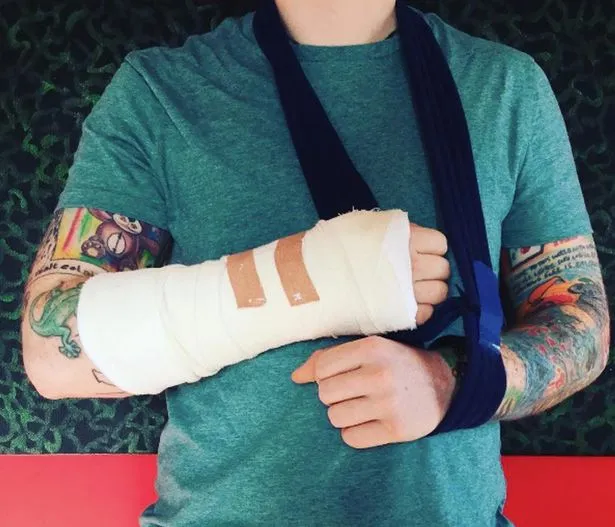 Ed Sheeran alami kecelakaan © Instagram.com/edsheeran