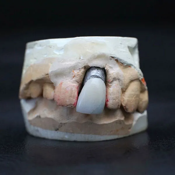 Gigi Palsu Elvis yang akan dipamerkan @gigwise.com