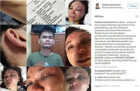 Fadlan mengungkap adiknya baru saja dipukuli pria bernama Rahmat Sesario. © instagram.com/fadlanmuhammad