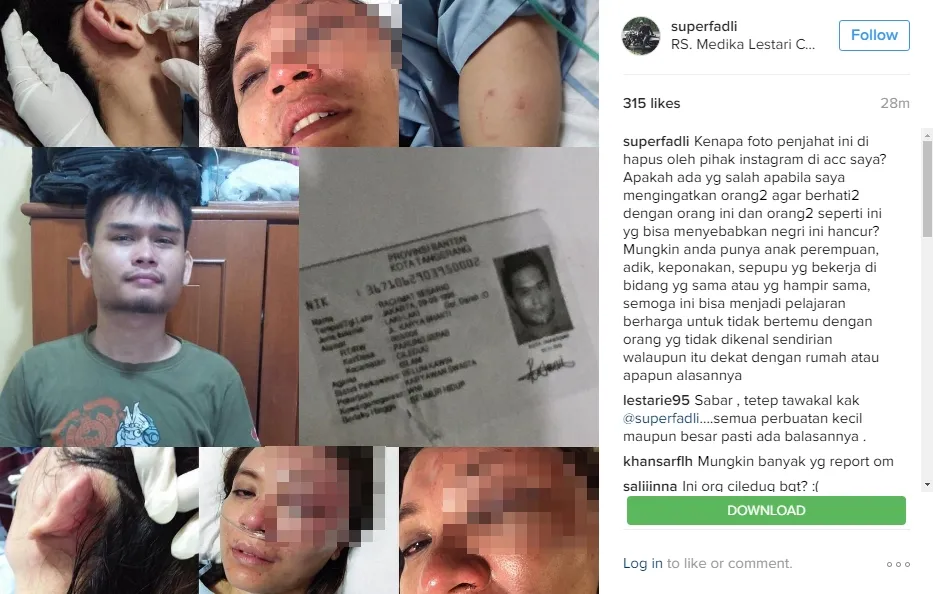 Adik Akhmad Fadli dipukuli. © instagram.com/superfadli