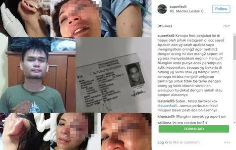 Adik Fadli - Fadlan jadi korban tindak penganiayaan © Instagram/superfadli