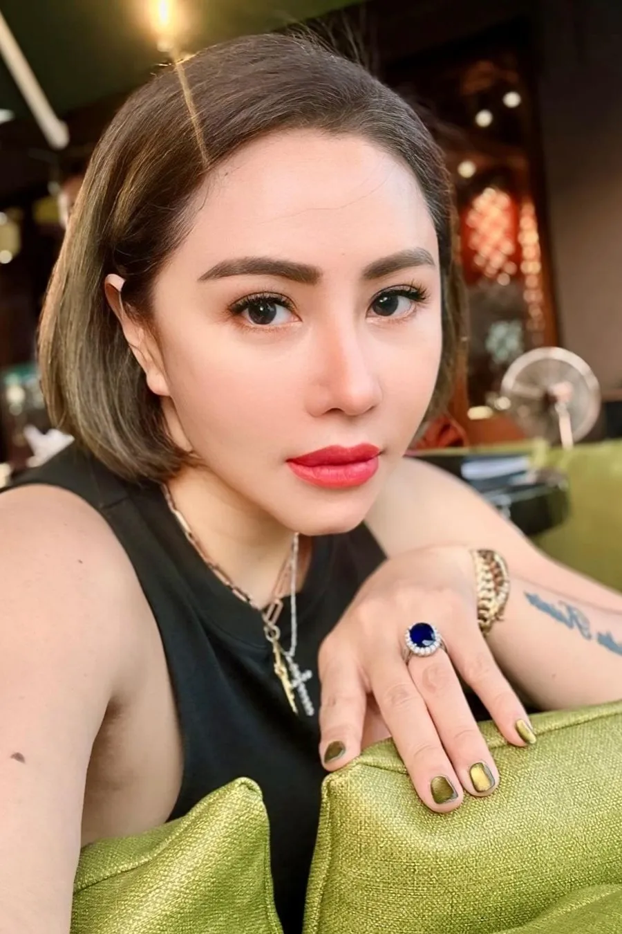Pernah Koma Hingga Amnesia dan Tak Kenali Orang