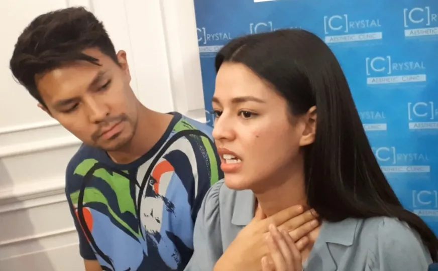 Fero Walandouw dan Susan Sameh © KapanLagi.com®/Adi Abbas Nugroho