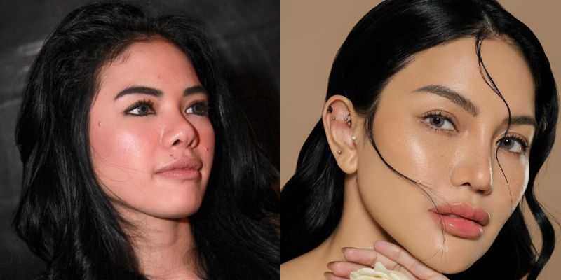 9 Transformasi Artis Sebelum Dan Sesudah Filler Dagu Wajah Makin Tirus