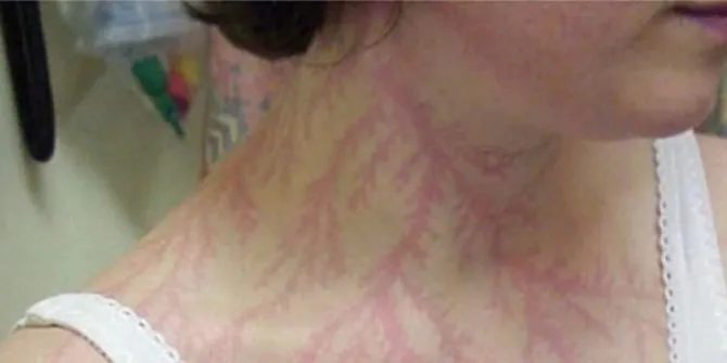 (credit: plus.kapanlagi.com/Ferry Sanjaya)