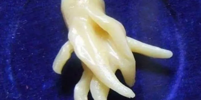 (credit: plus.kapanlagi.com/Ferry Sanjaya)