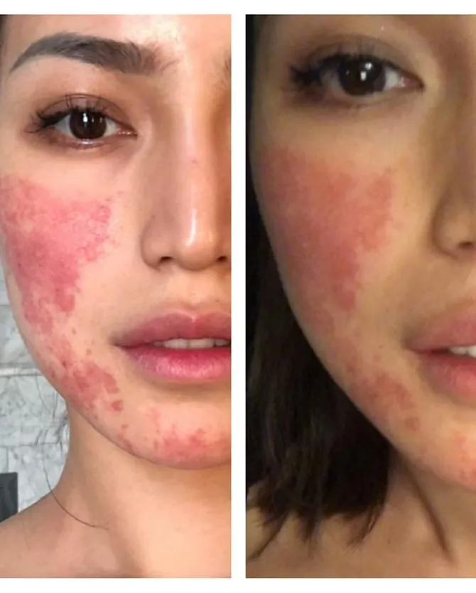 Jessica Iskandar © instagram.com/inijedar