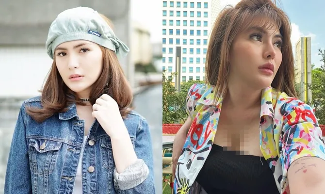 Angela Lee Lakoni Filler Bibir Agar Lebih Sensual © instagram/angelalee87