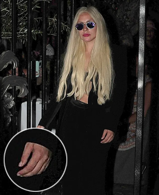 Gaga lepas cincin tunangannya dengan Taylor © istimewa