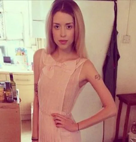Kurusnya tubuh Peaches Geldof @ dailymail.co.uk