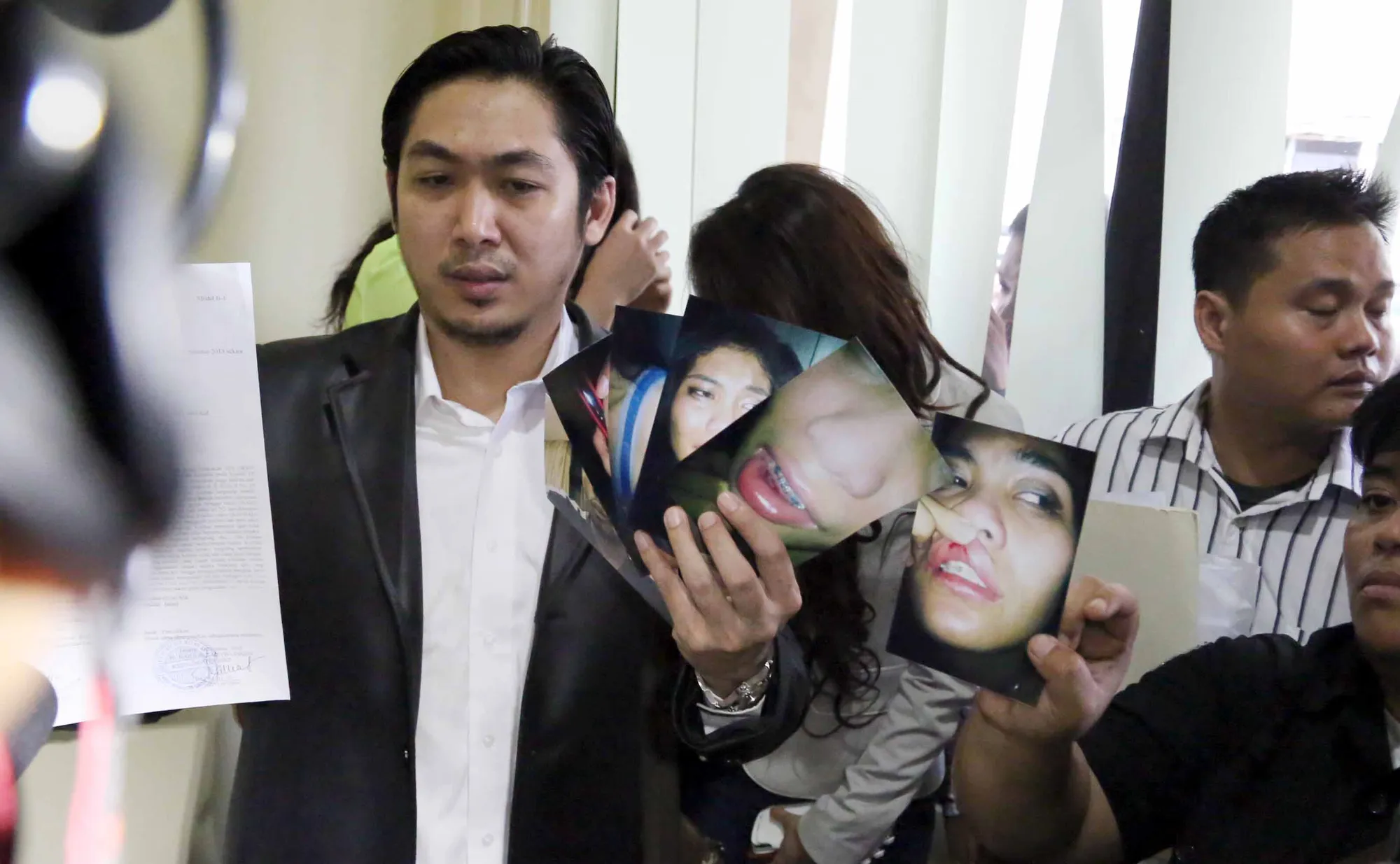 Pengacara Rahelia Geby menunjukkan foto penganiayaan yang dialami Rahelia Geby