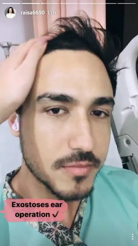 Hamish menderita exotosis ear yakni pembengkakan tulang lunak di saluran telinga, diduga karena kegemarannya berselancar © instagram.com/raisa6690